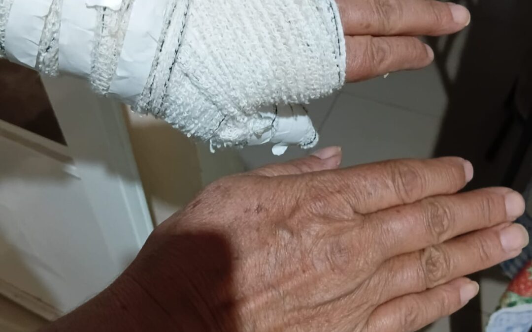 Saúde: Paciente relata espera por cirurgia na mão
